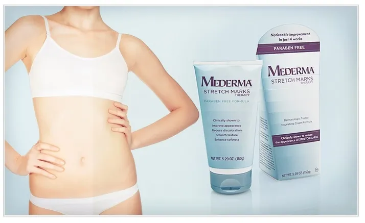 Groupon: 5.29 Oz. Box of Mederma Stretch Marks Therapy Cream