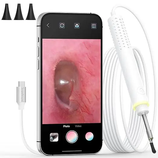 ScopeAround Otoscope with Ear Camera 3.9mm Ultra-Thin and 6 LED Lights