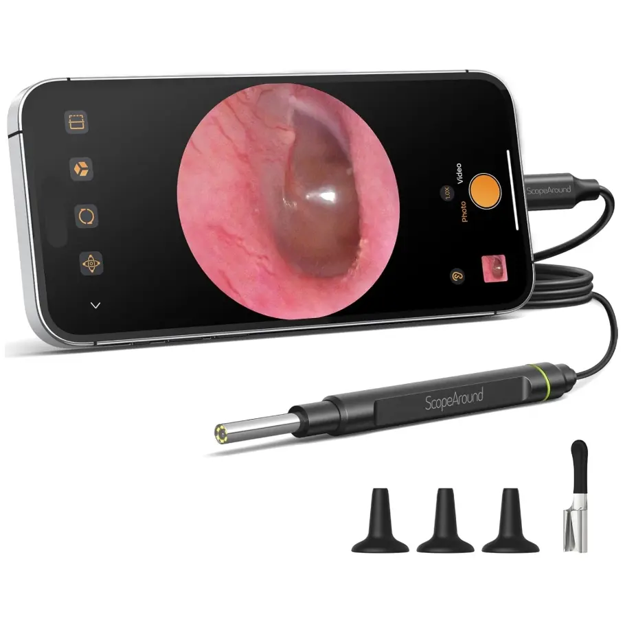ScopeAround Otoscope with Light