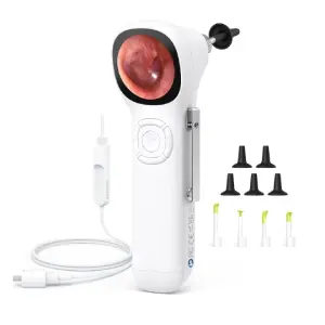 ScopeAround Digital Otoscope with IPS Screen